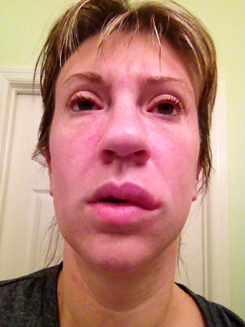 I am doing my best not to lose my mind here! This is me make up free with hives on my face.