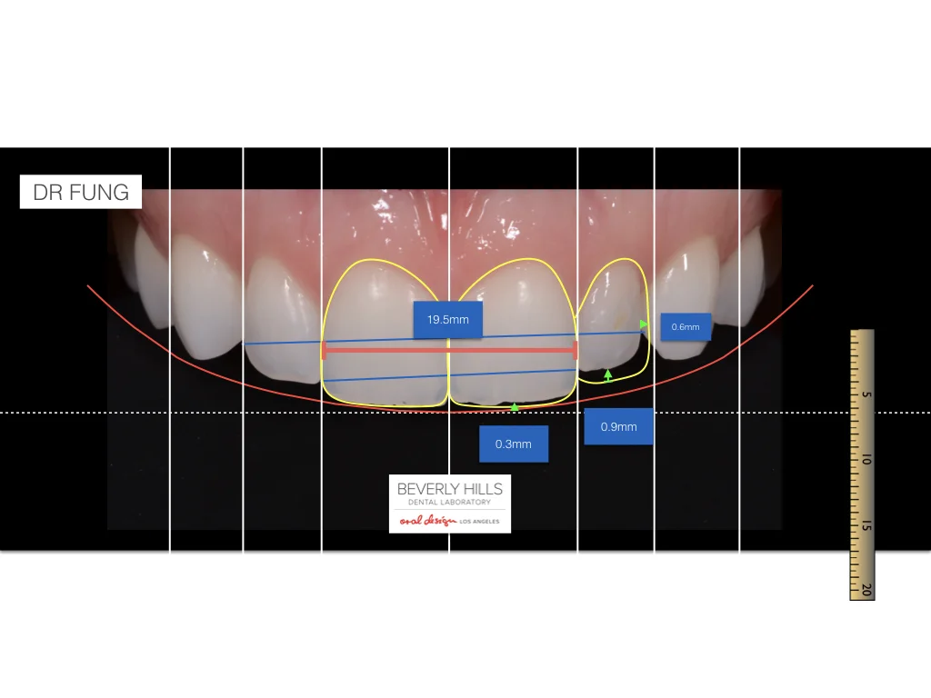 Digital Smile Design