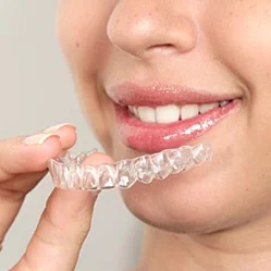 clearpathaligners.jpg