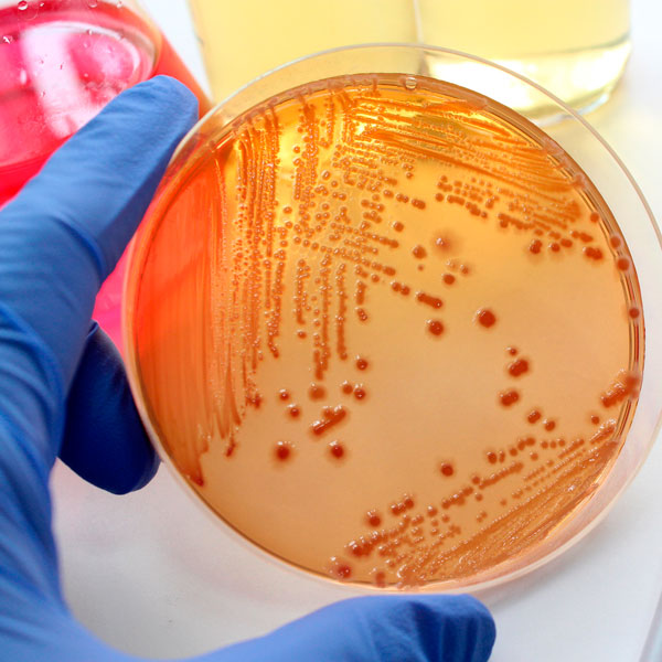 Solving bacteria problems in well water