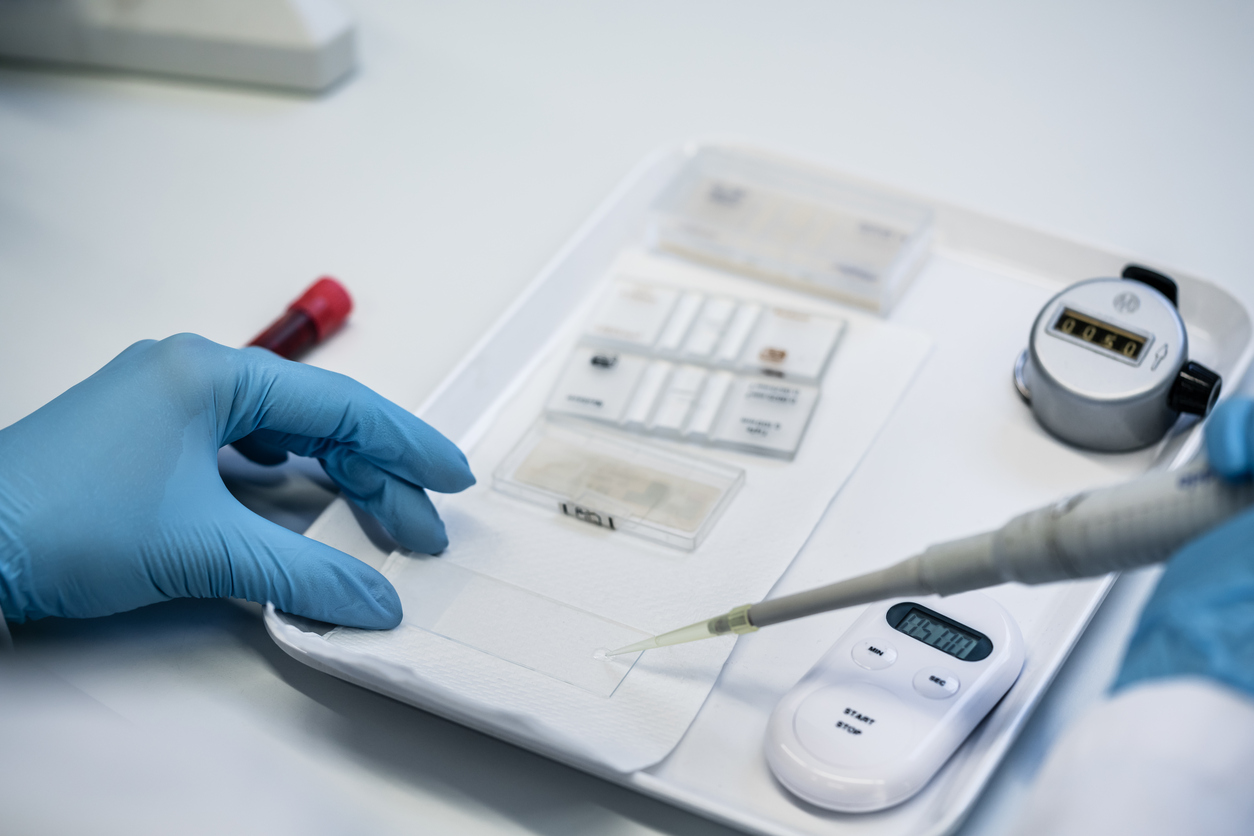 Sample preparation.jpg