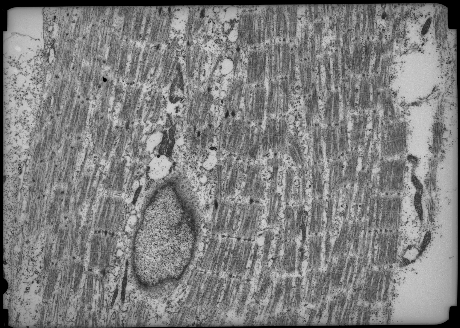 Sarcomere organization of matured hPSC-myotubes