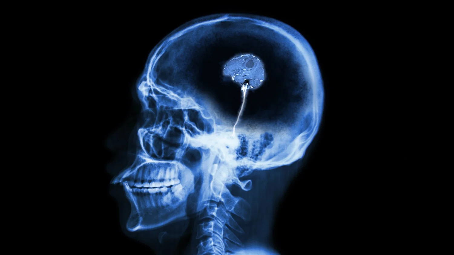 Of Moral Relativism &amp; the Engineering of Struggles