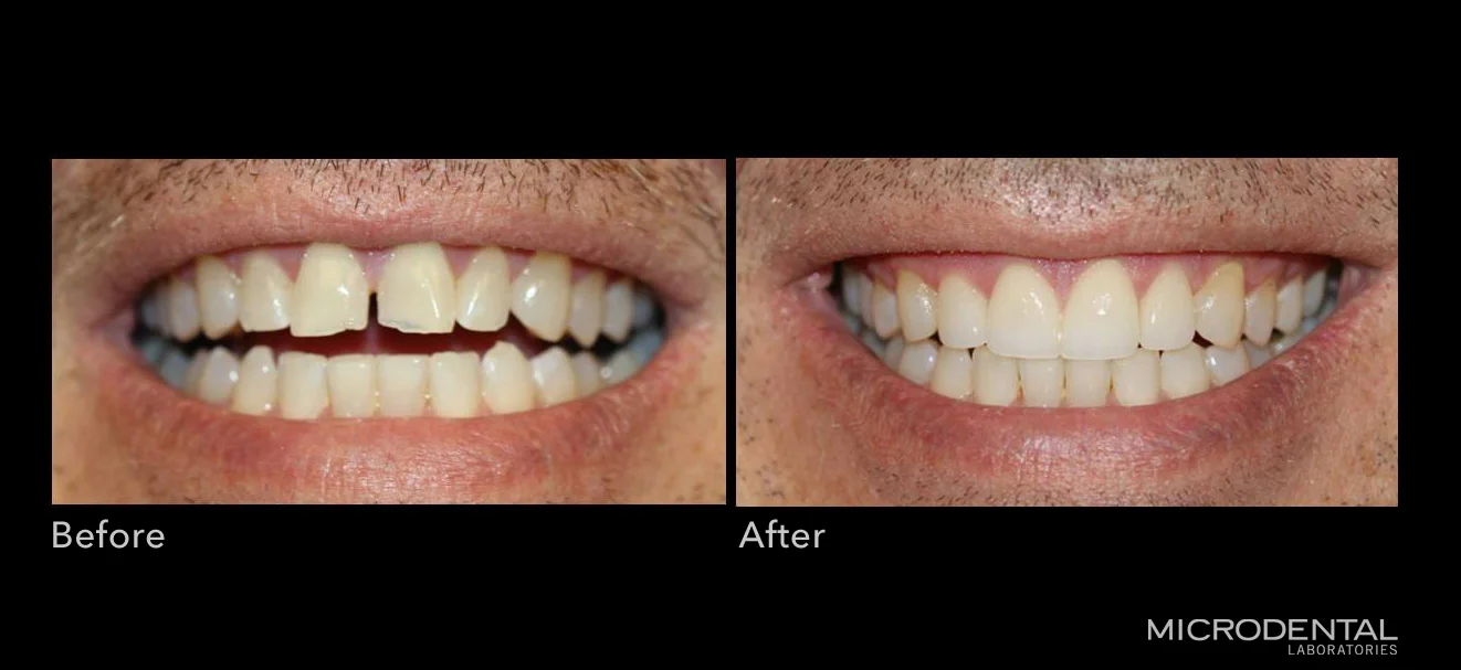 Dentistry by Dr. Todd Emigh, Long Beach, CA