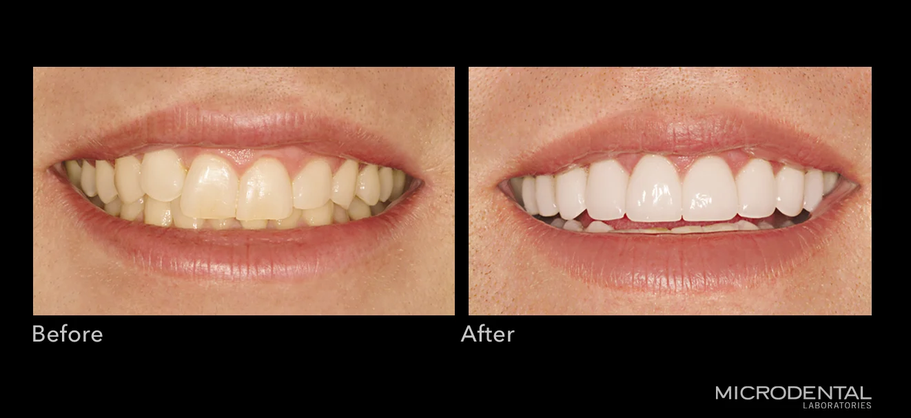 Dentistry by Dr. Kenneth Hamlett, Dallas, TX