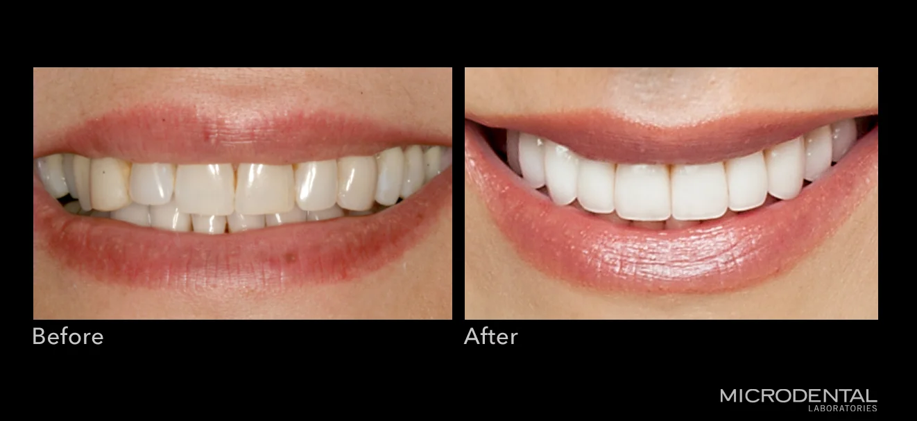 Dentistry by Dr. Alan Montrose, Beaverton, OR