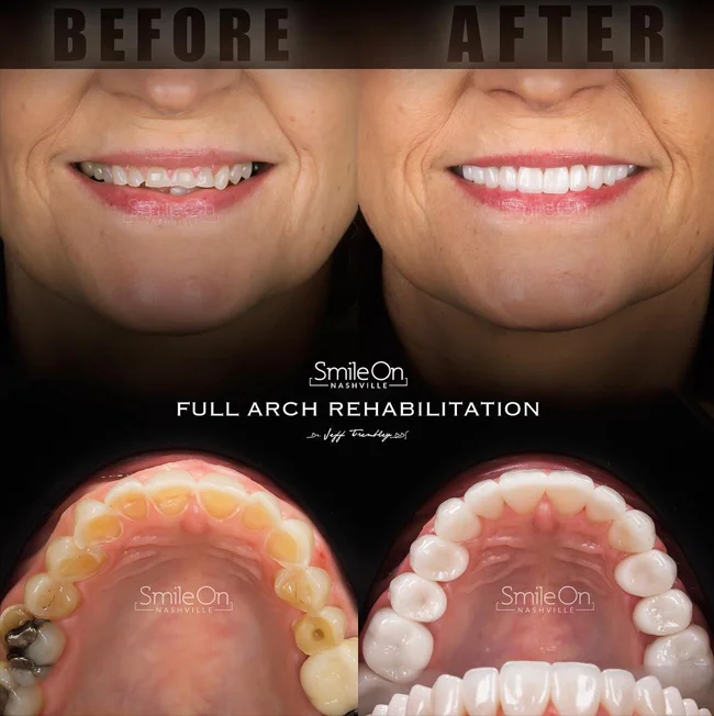 MicroDental.jpg