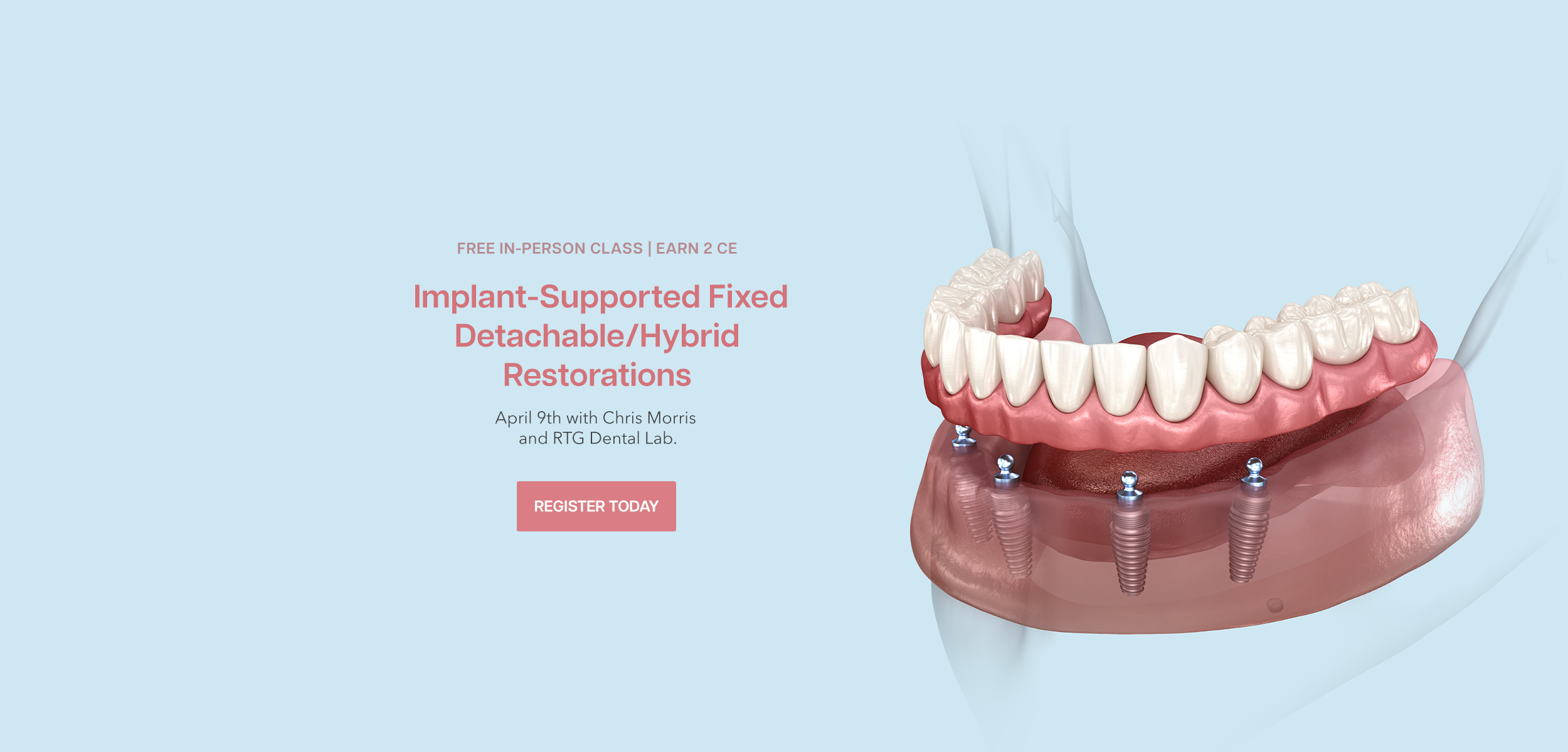260308 RTG All-on-X Restoration 4.9.26 CE - Web Banner.png