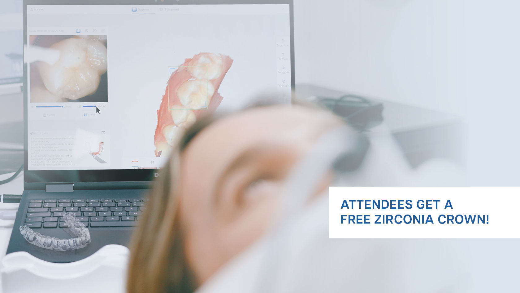 Man being scanned with an intraoral scanner with a laptop and clear aligner behind him