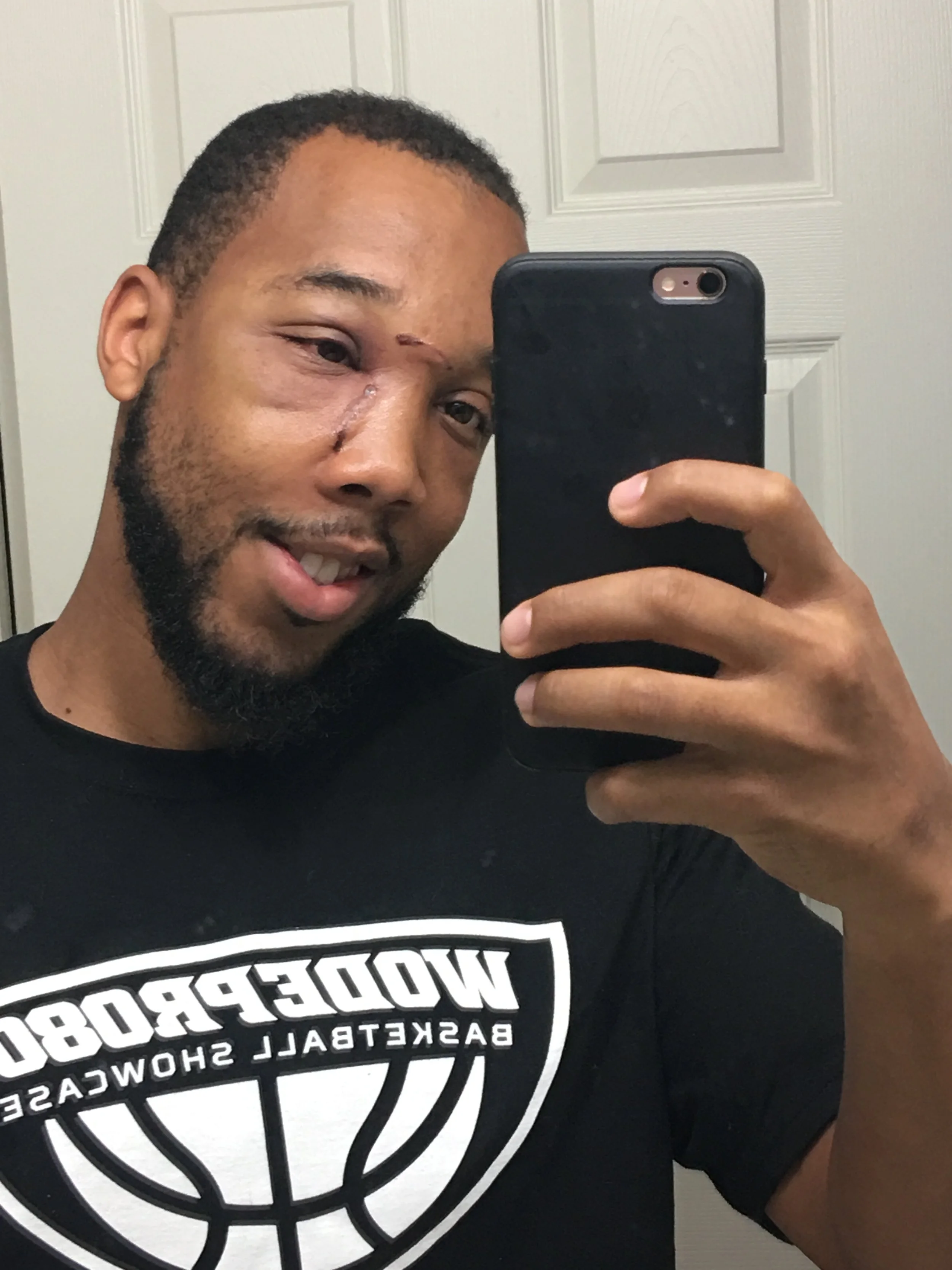 Post Neoplasm Surgery / Cancer Diagnoses 