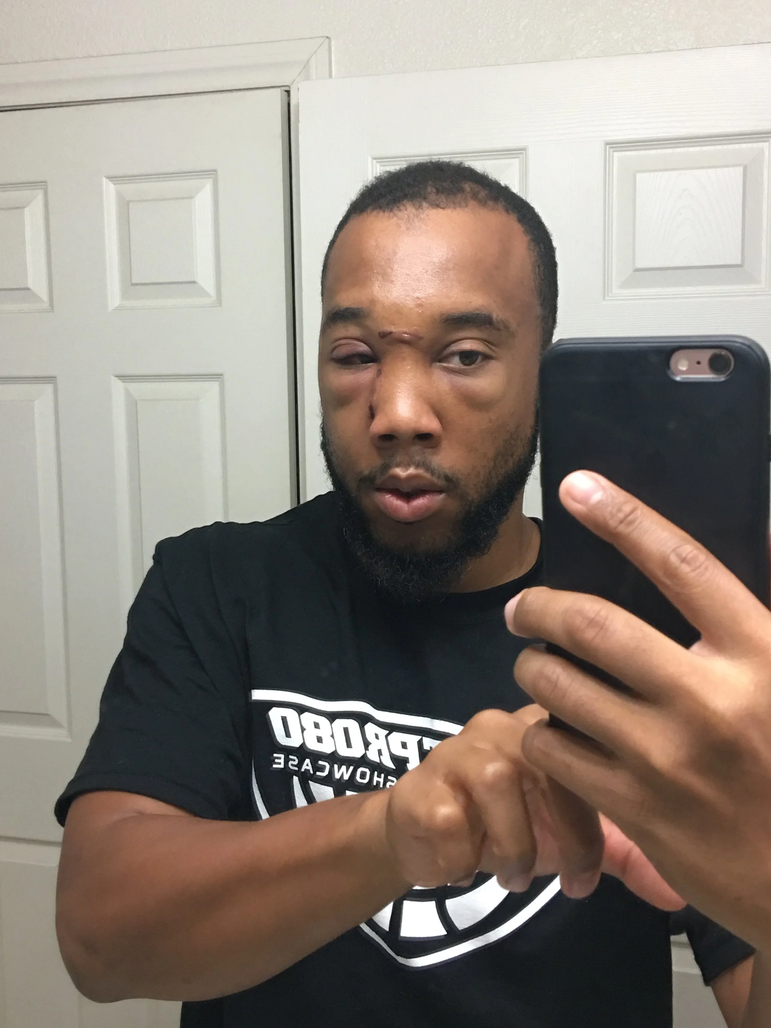 Post Neoplasm Surgery / Cancer Diagnoses 