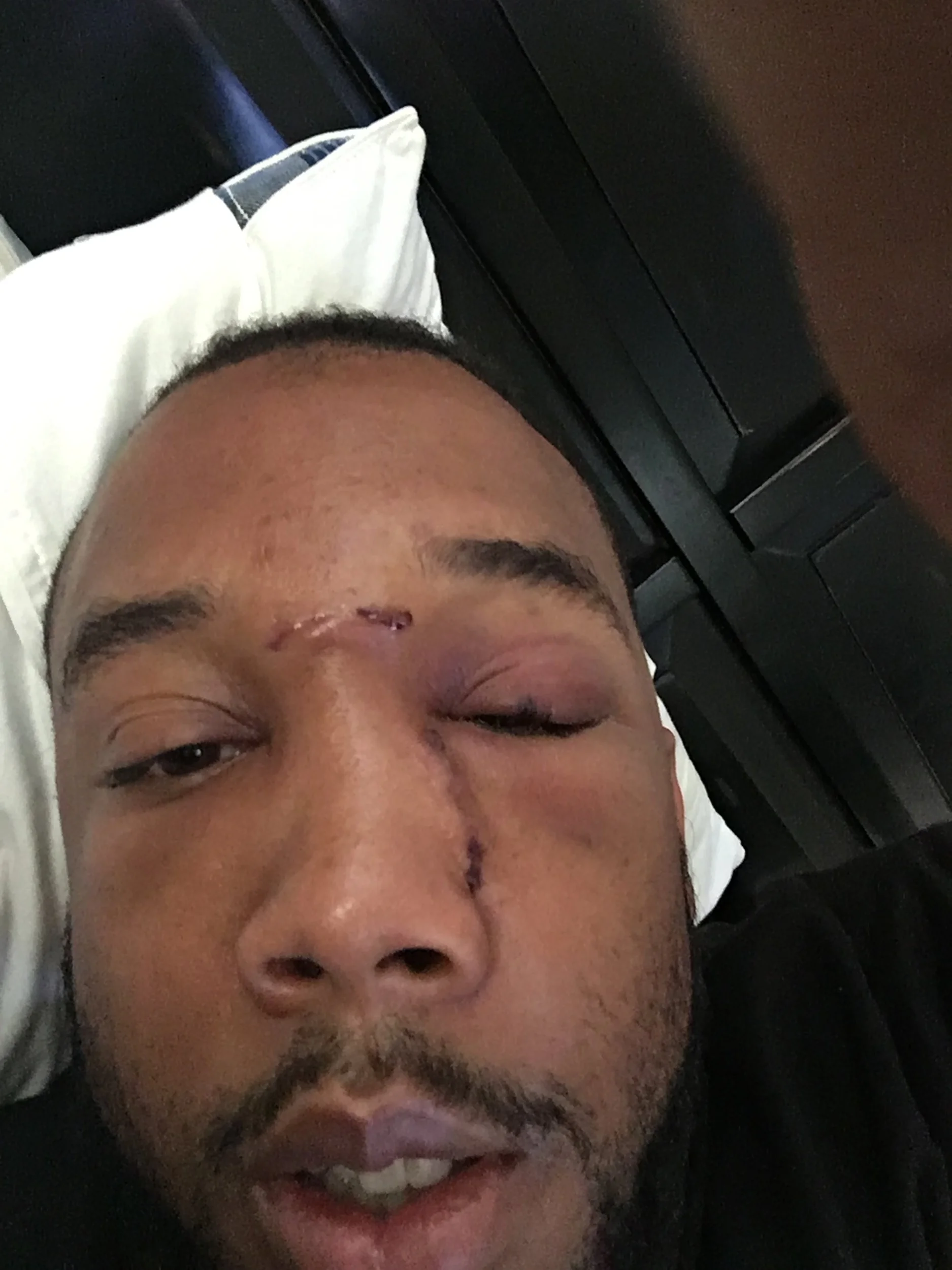 Post Neoplasm Surgery / Cancer Diagnoses 