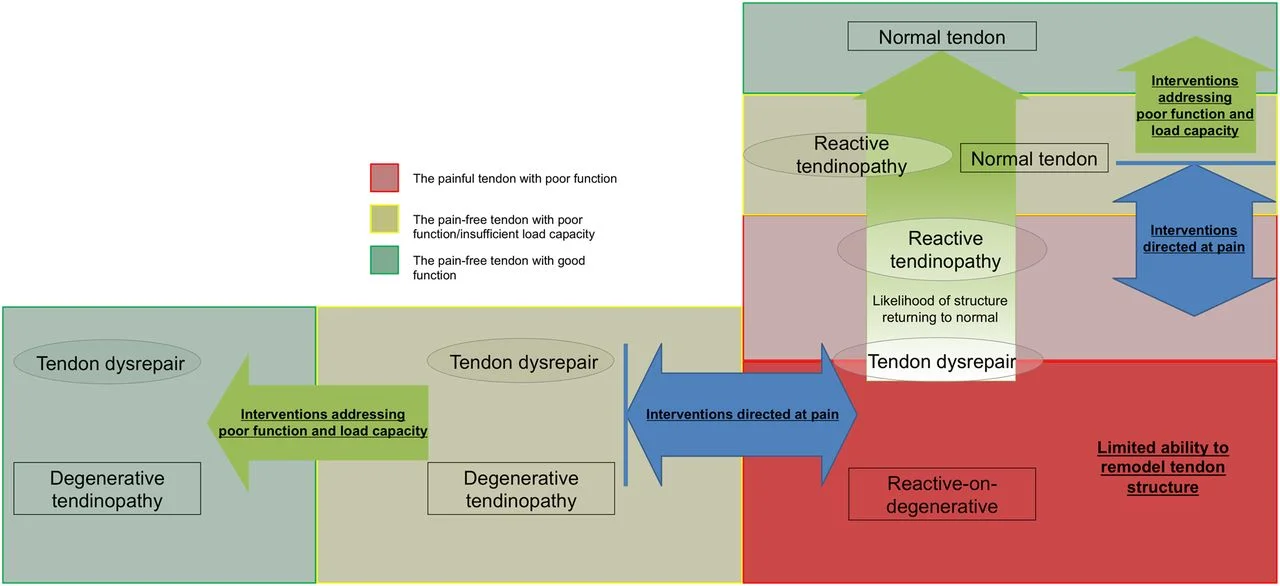 A pictorial depiction of tendinopathy as a continuum. &nbsp;Reprinted from British Journal of Sports Medicine, 2016.