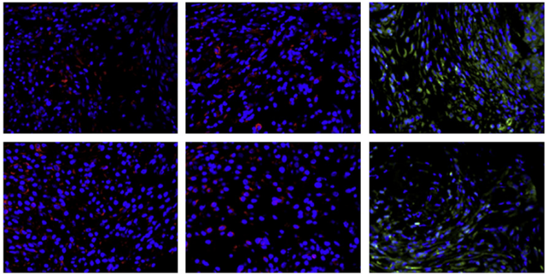 [25] The Promotion of Functional Urinary Bladder Regeneration Using Anti-inflammatory Nanofibers