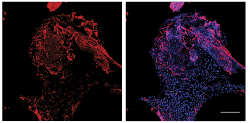 [31] Neutrophil Responses to Sterile Implant Materials