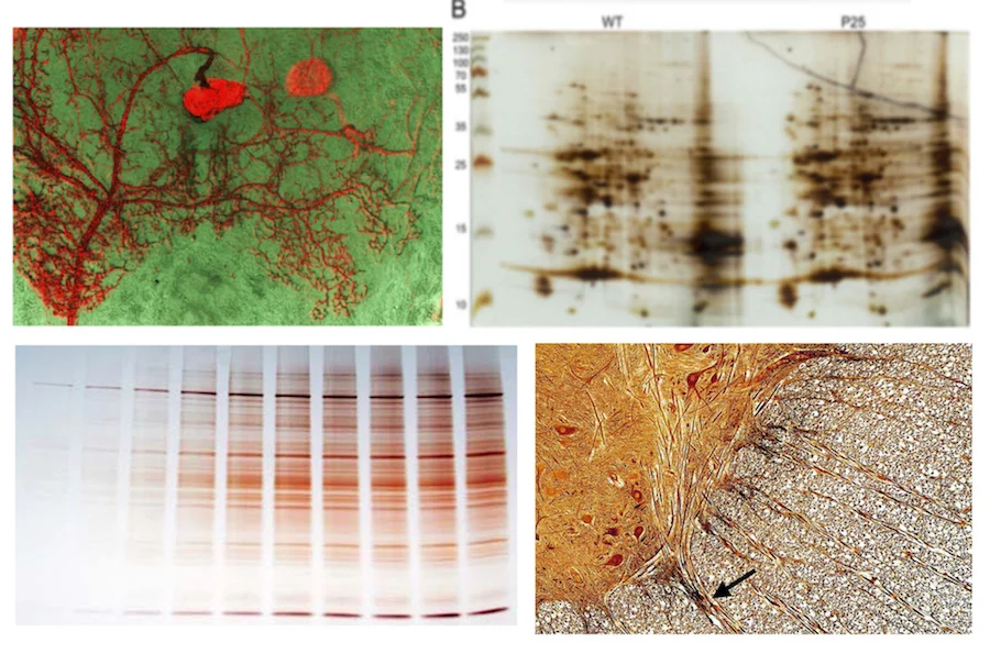 Image results of silver staining.