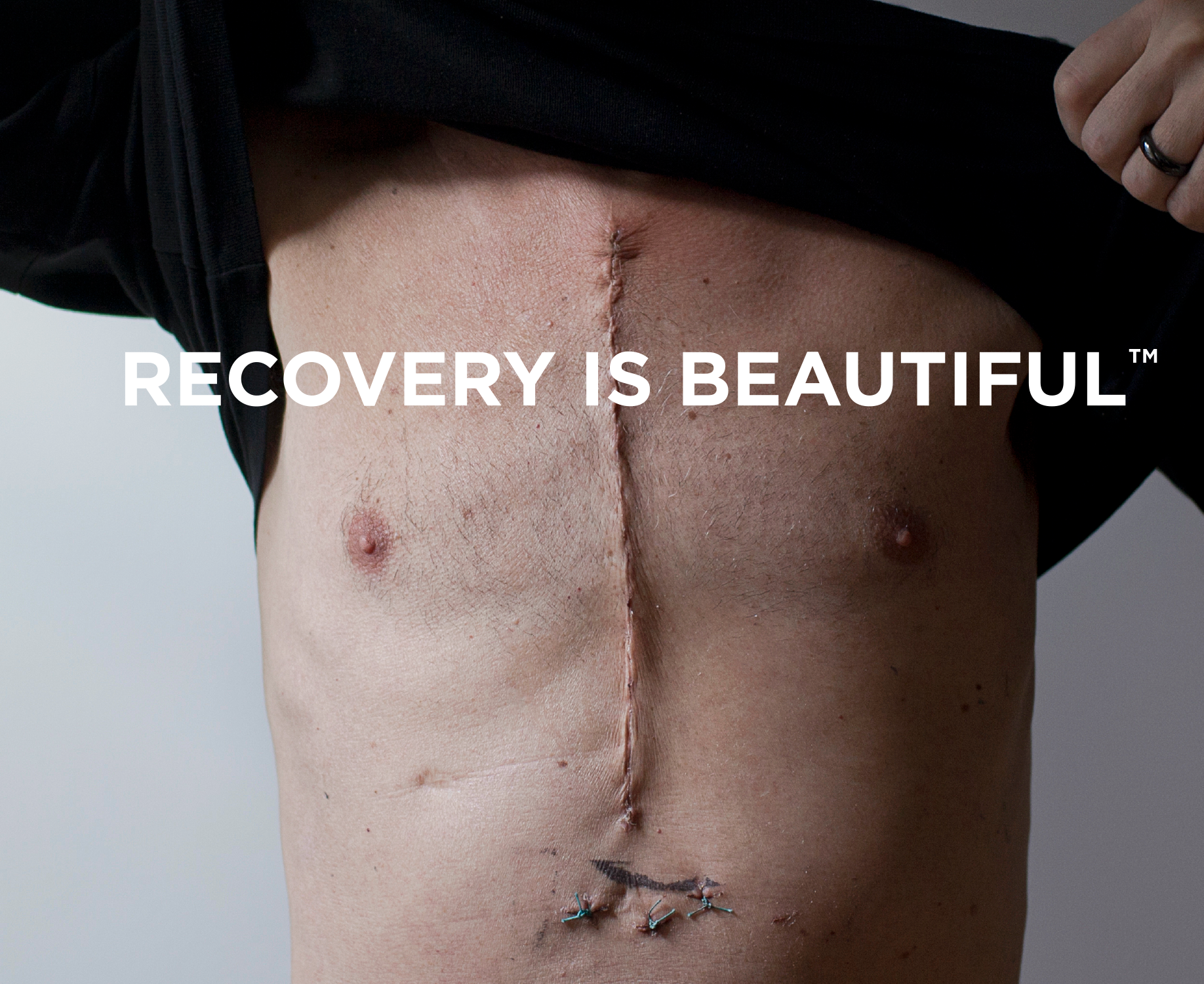 RecoveryIsBeautiful_Featured_Image4.png