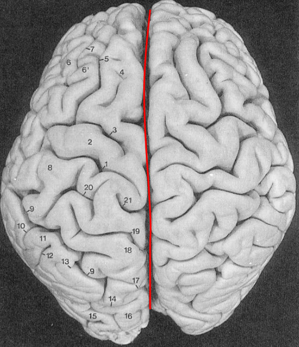 Primer on Cortical Sulci — fMRI 4 Newbies
