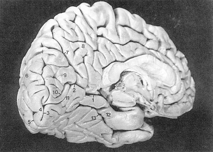 dov_occippole_Lhem_medial.jpg