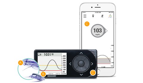 Medicare now offers reimbursement for the Dexcom G5 Mobile System for members who have type 1 or type 2 diabetes and intensively manage their blood sugar levels with insulin.