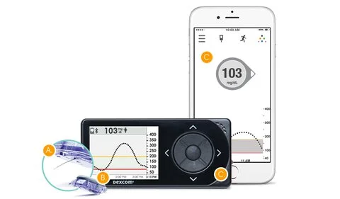 dexcom g5.jpg