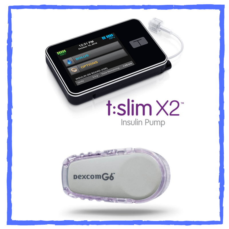 Why The Tandem T slim X2 Insulin Pump With Dexcom CGM Is An Excellent 