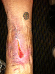 AFTER – June 20, 2012