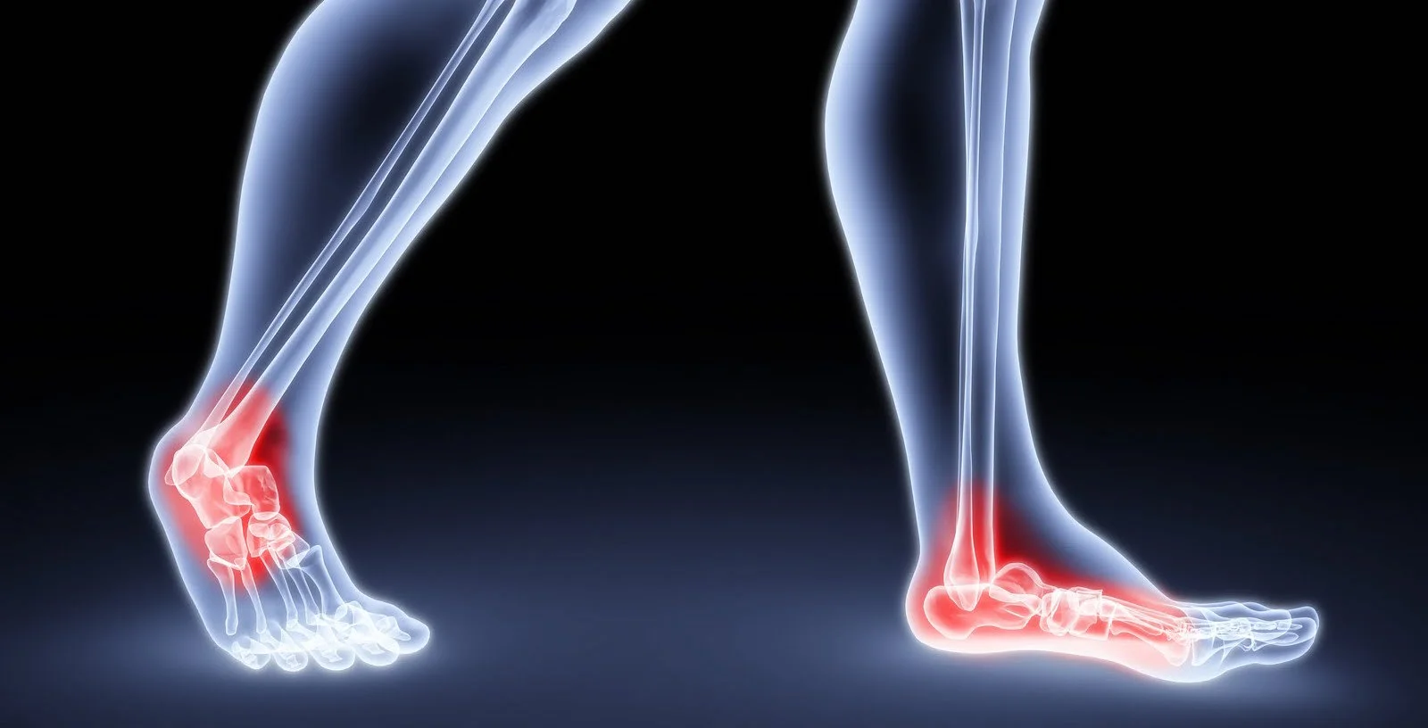 Could That Pain in Your Foot Be Arthritis? — Foot and Ankle Specialists