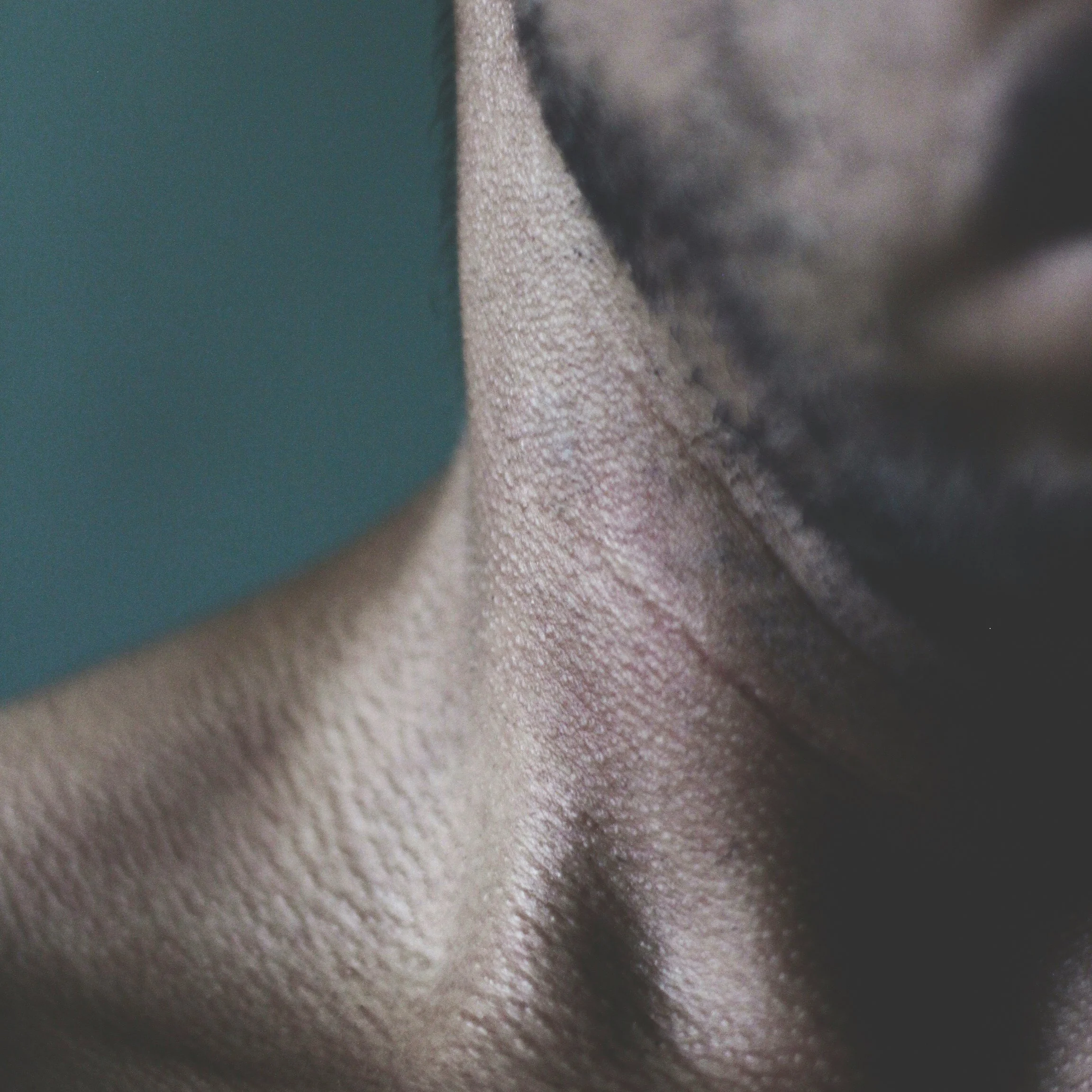 Ulthérapie | Ultherapy HIFU