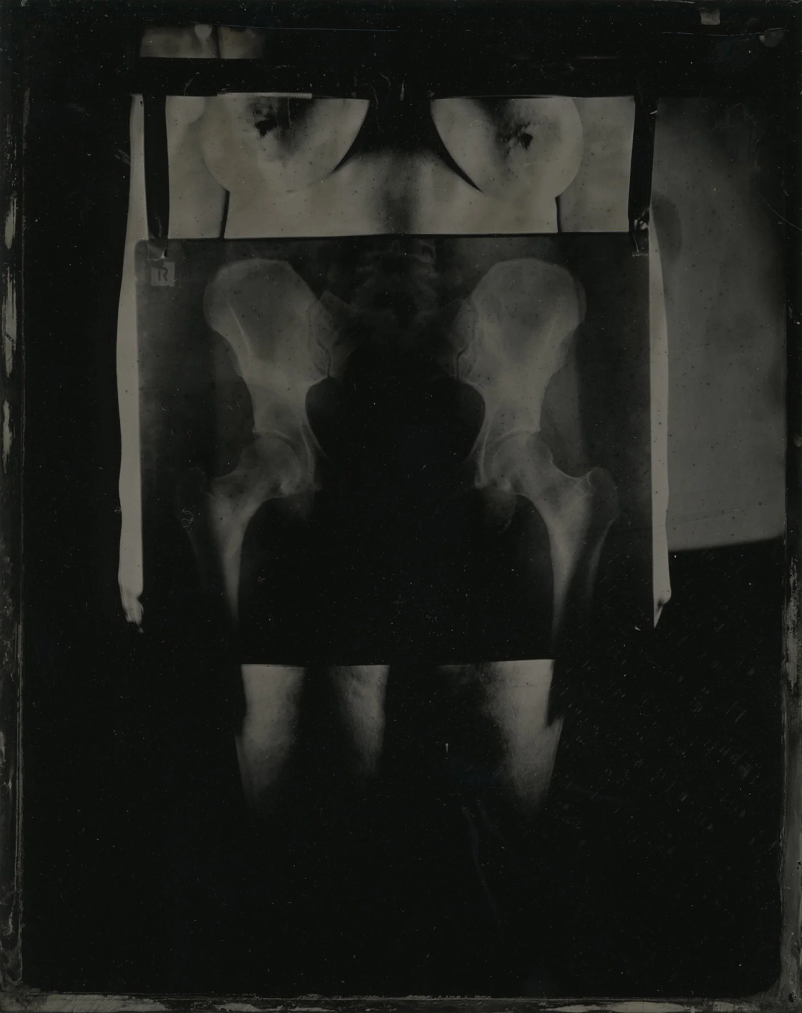 Title : Pelvis By: Keira Hudson https://keirahudson.weebly.com/
