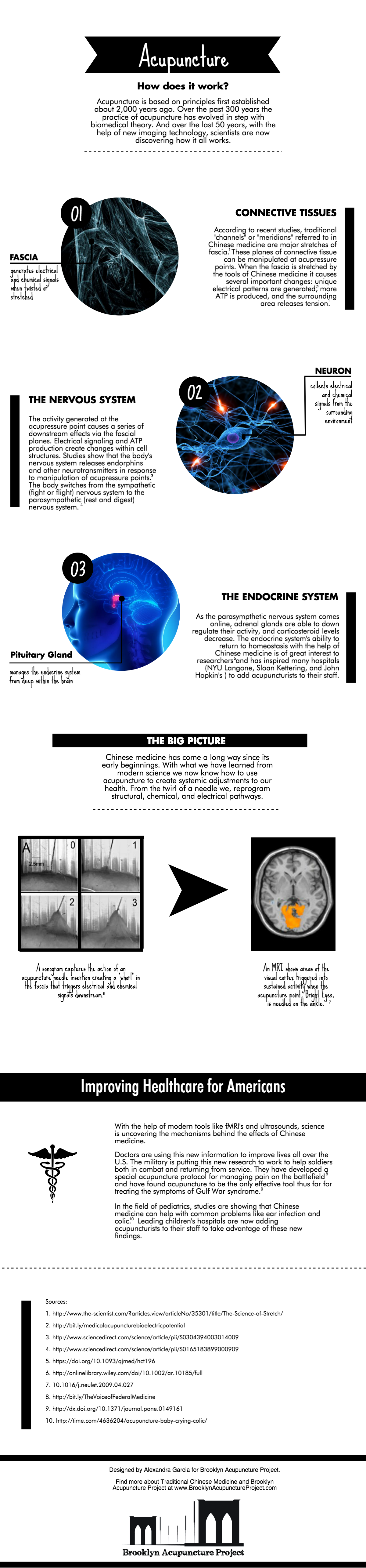 how acupuncture works