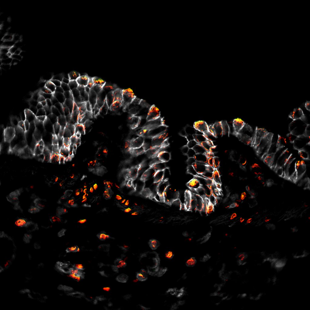 P283 Lung 2-Merge.jpg