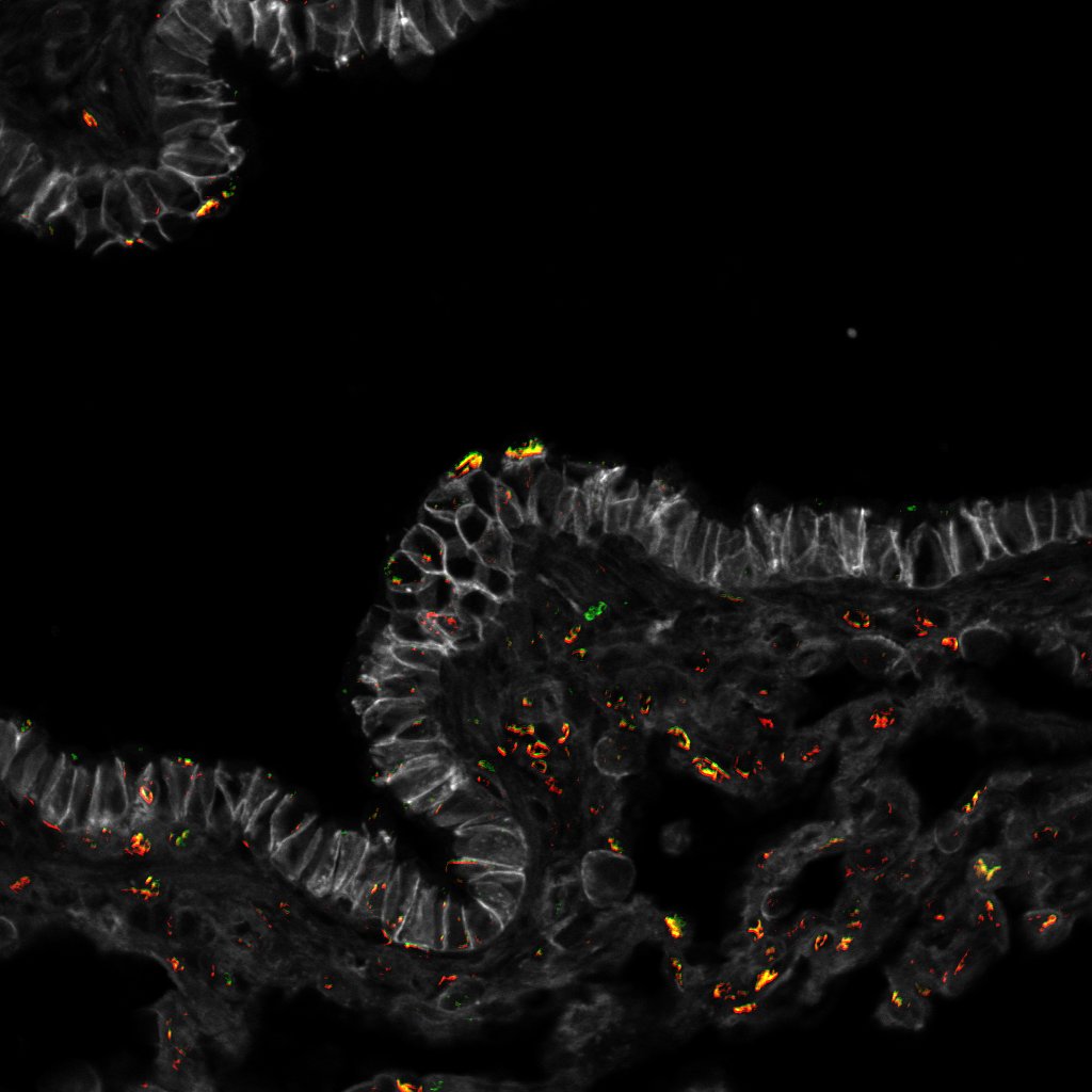 P282 Lung 1-Merge.jpg