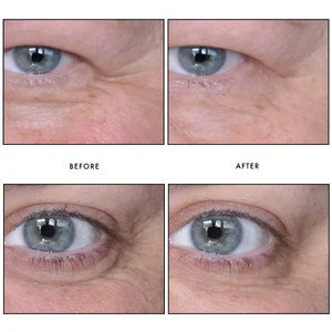 revision skincare revox 7