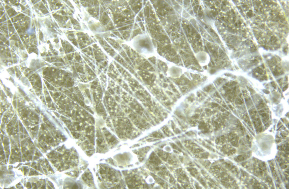 Skærmbillede 2018-06-11 kl. 13.48.17.png