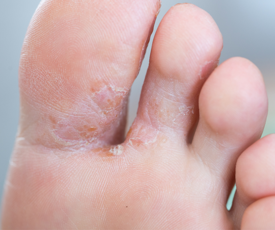 Is That White Spot Fungus or Just Dryness?