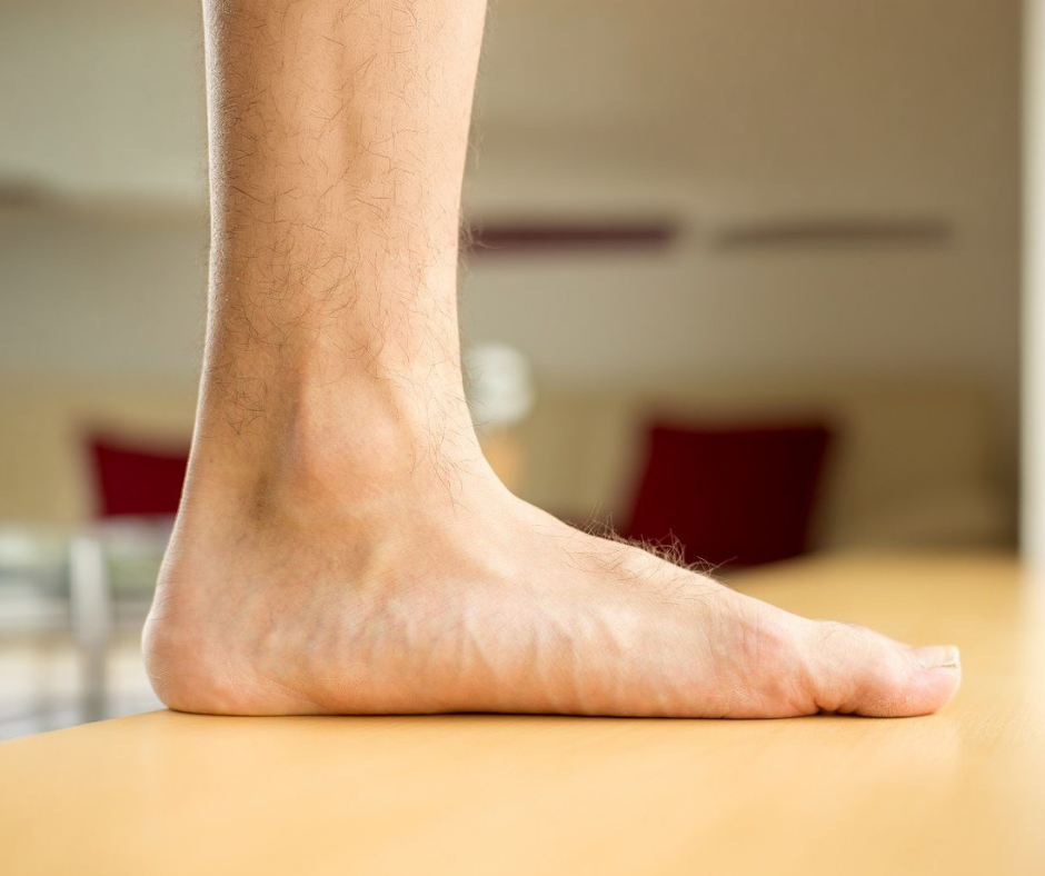 Why Did My Foot Suddenly Become Flat?