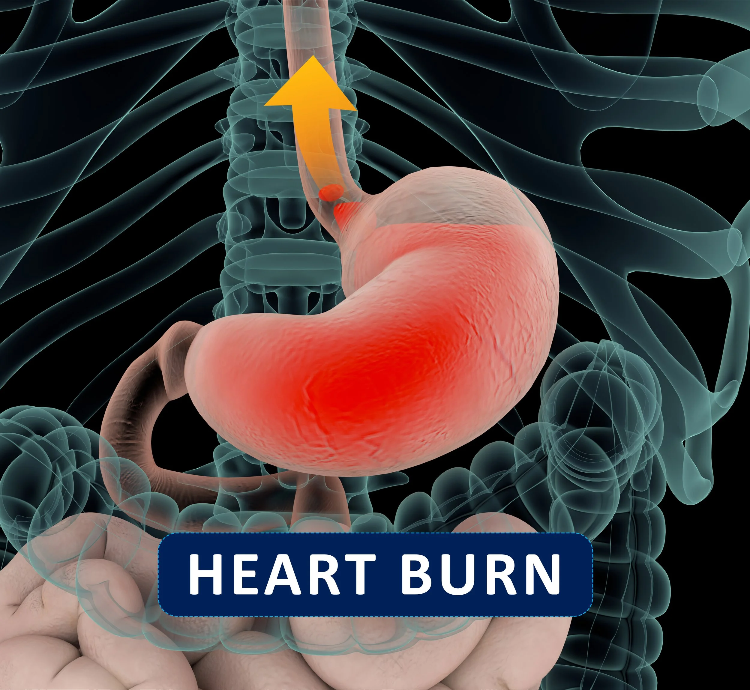 Heartburn FAQs: Frequently Asked Questions About This Pesky Condition