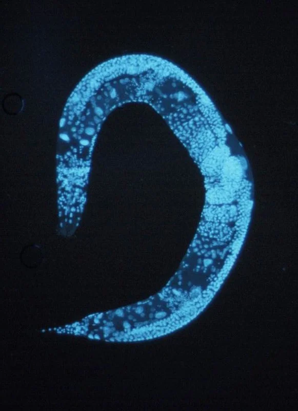 800px-Caenorhabditis_elegans.jpg