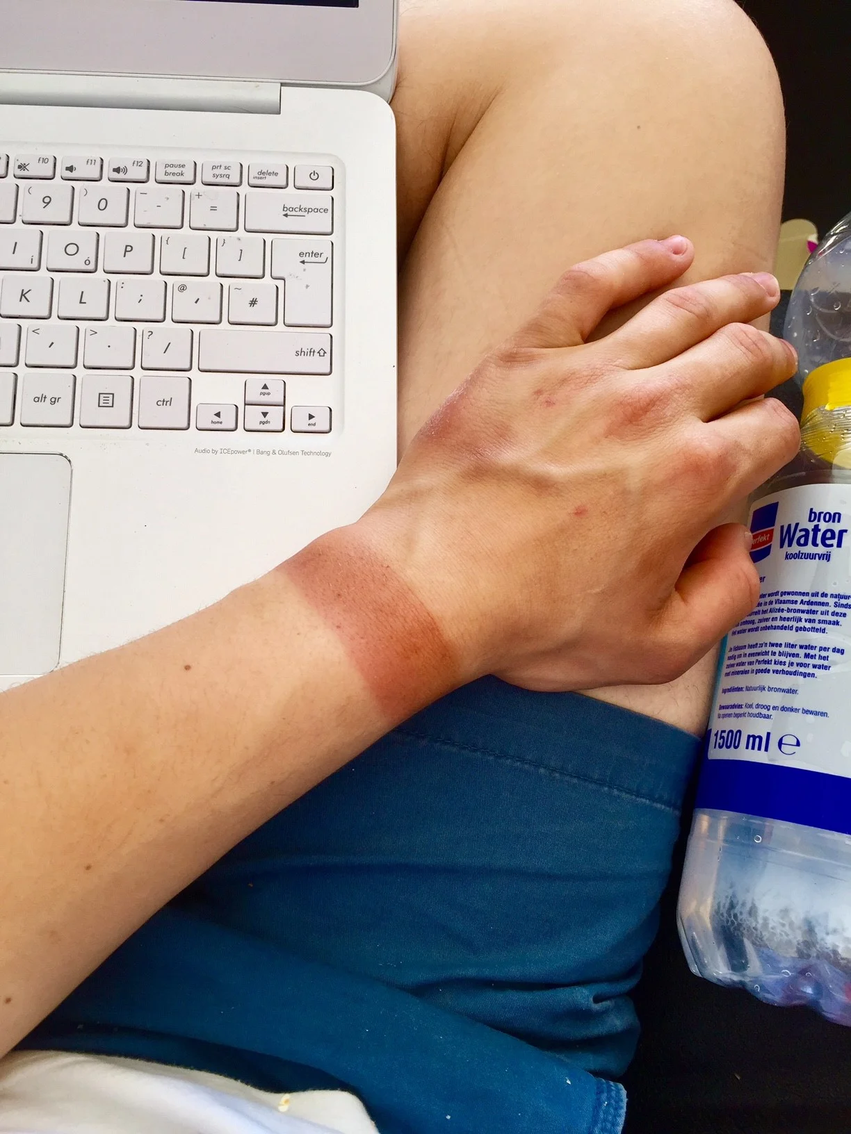 Sailing causes some pretty bad tan lines as I found out during the week.
