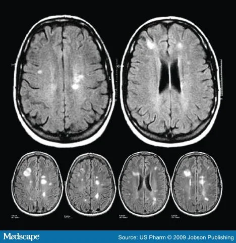 588913-fig2