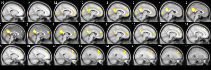 brainybrainz.png