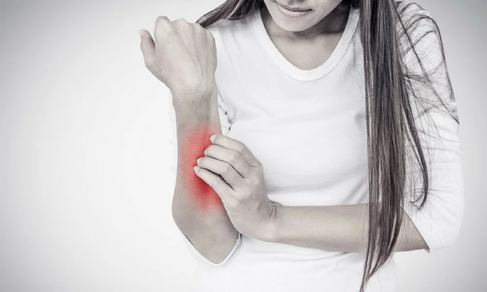 6 Home Remedies to Relieve Psoriasis