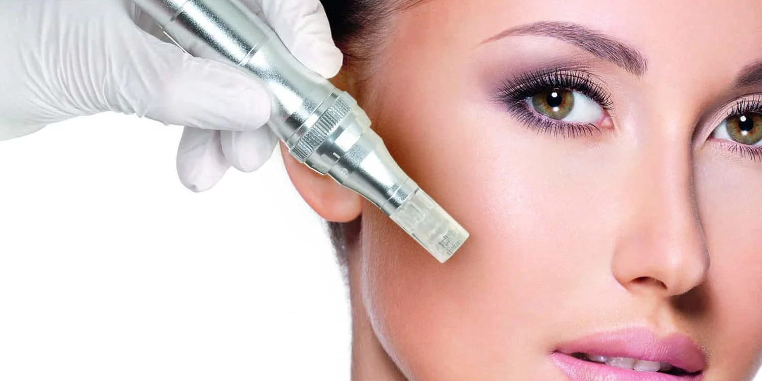Microneedling-TF-1500x750.jpg