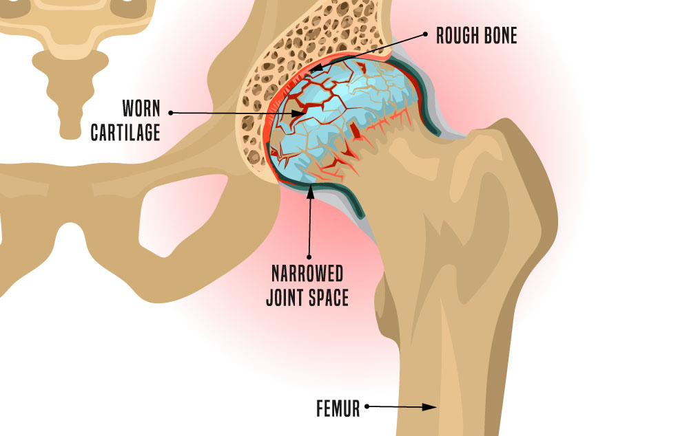 In dire need of pain relief but without the side effects of painkillers