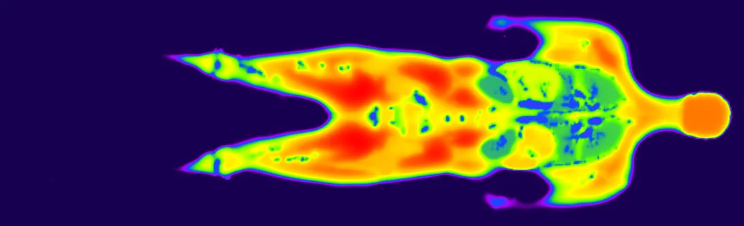 Computed initial temperature distribution for a human showing the effects of metabolic processes.