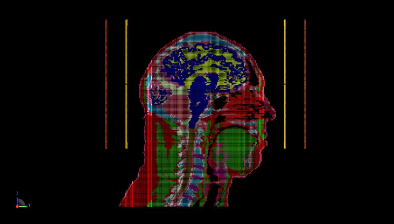 Figure 7: PrOGrid mesh representation of the sagittal plane of the head and coil geometry.