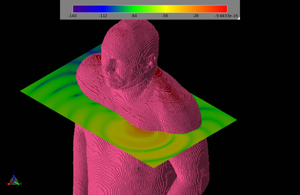 Figure 7: A slice of time domain fields through the chest.