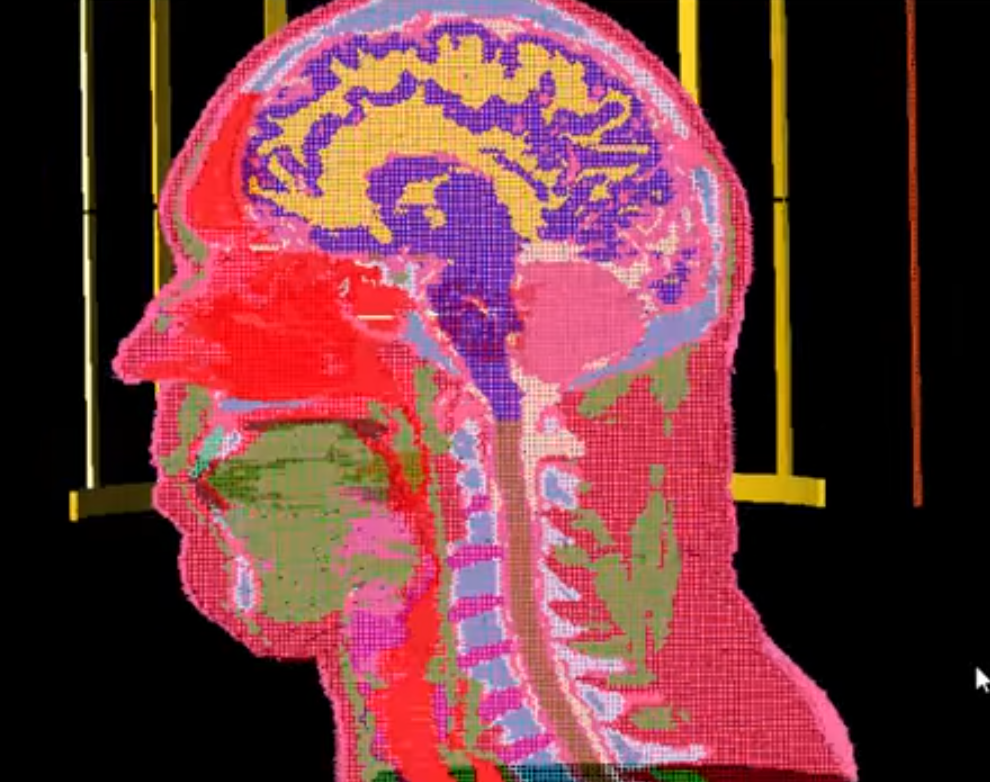 EM Simulation Meshing in XFdtd