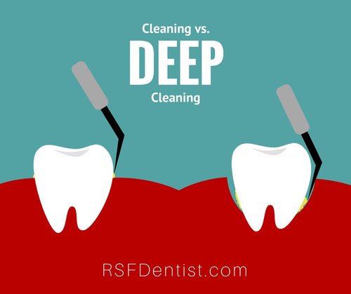 Whats The Difference Between Deep Cleaning And Regular Cleaning?